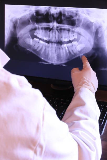 Best Emergency Tooth Extraction in Harbour Heights, FL